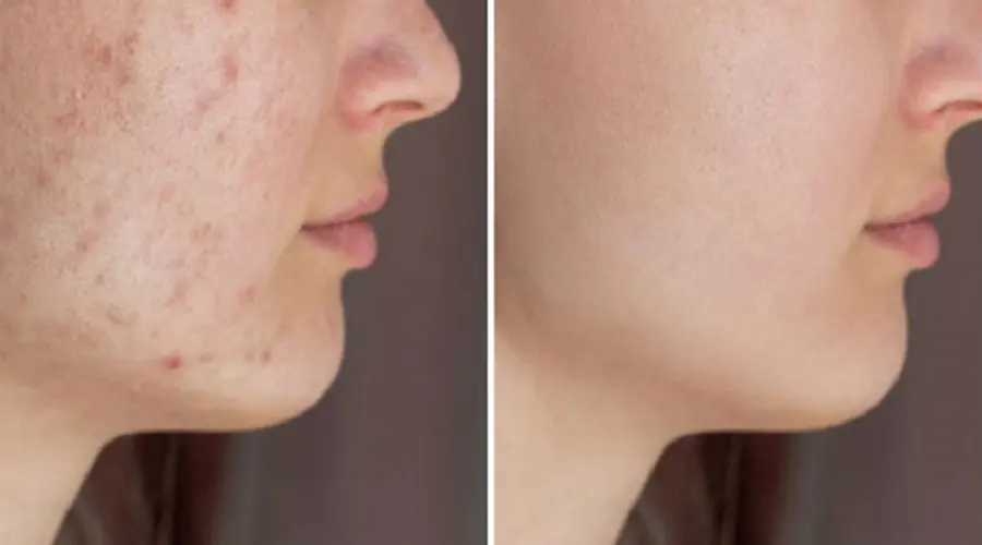 بهترین روش خرید روغن رفع لک های پوست صورت تماس با دکتر اویل است