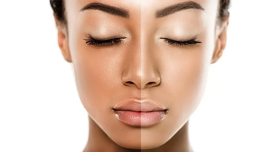 قیمت خرید روغن رفع تیرگی پوست از فروشگاه اینترنتی دکتر اویل