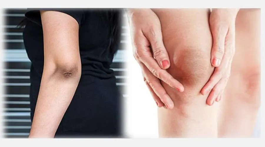 ترکیبات روغن رفع تیرگی پوست محصول دکتر اویل