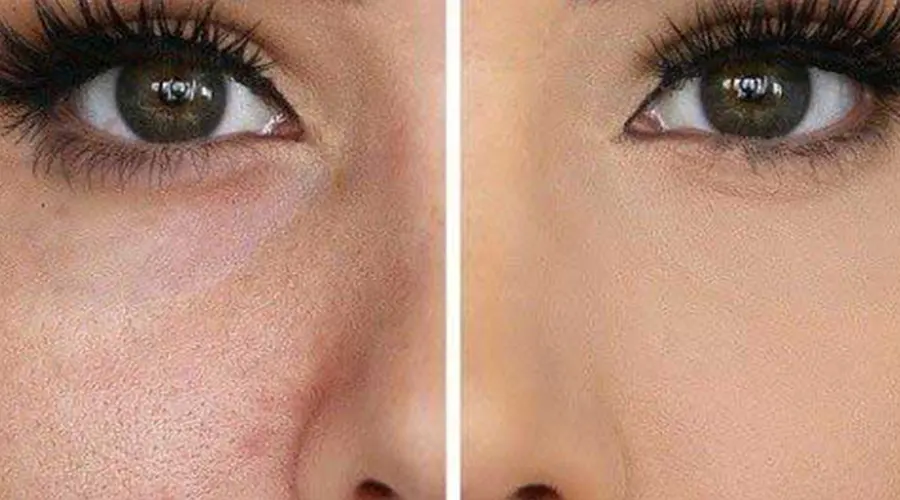 طریقه مصرف روغن کنترل منافذ پوست