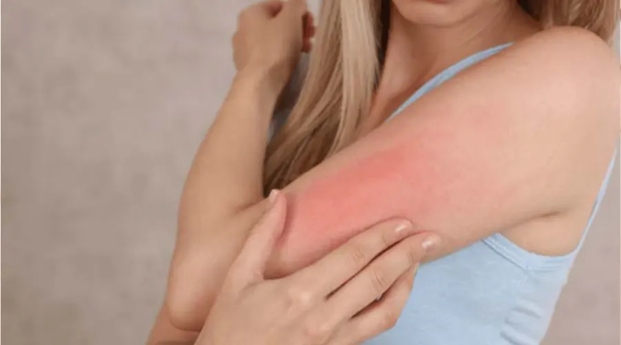 استعلام قیمت خرید روغن مناسب پوست حساس