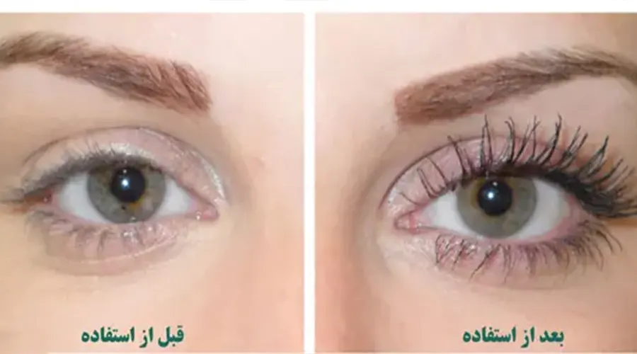 با استفاده از روغن کندوش شادابی و زیبایی پوست خود را تضمین کنید