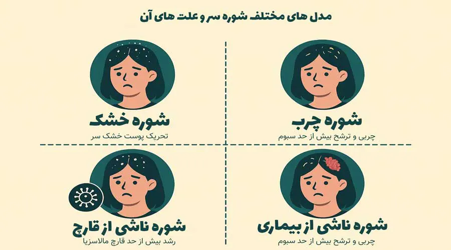 علت شوره زدن سر چیست و چه درمانی برای آن وجود دارد