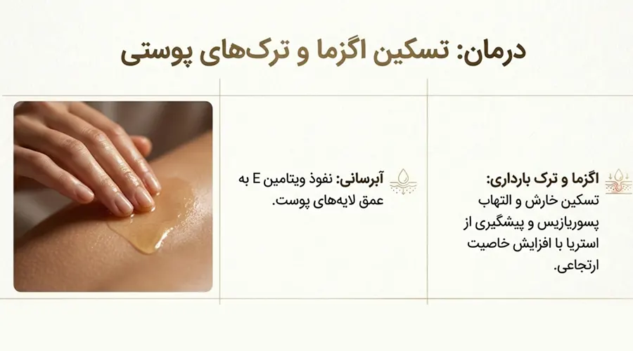 استفاده از روغن بادام تلخ ایرانی دکتر اویل برای اگزما و ترک پوستی