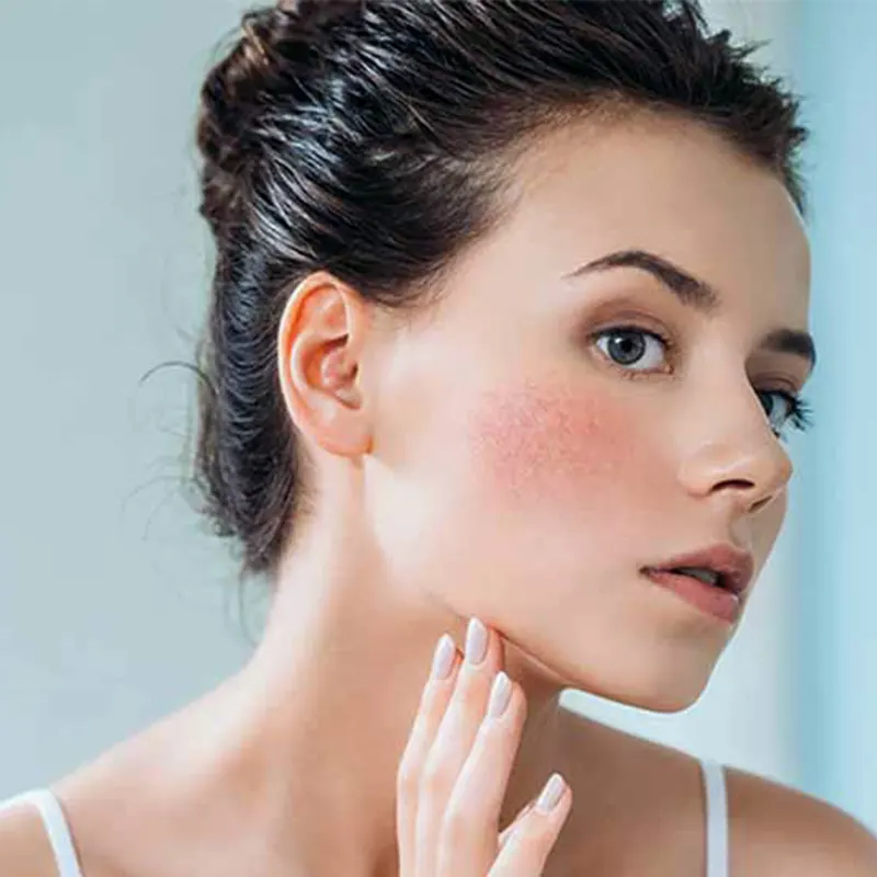روش های رفع حساسیت پوستی