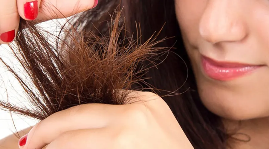 بهترین روش اینترنتی خرید صابون ضد موخوره از فروشگاه دکتر اویل