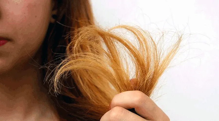 بهترین روش خرید اینترنتی روغن ضد موخوره