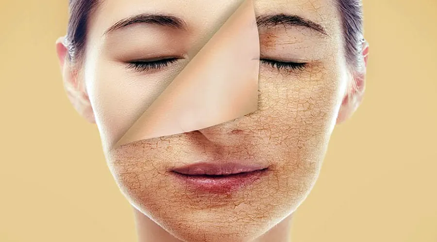 با استفاده صحیح و مناسب ازصابون نرم کننده پوست شاهد معجزه جوانی و زیبایی خود باشید.